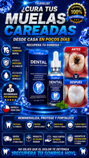 Dental Truerelief Curativa de Caries para Dientes