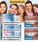 2X1 SOLO HOY   RESINA DENTAL MOLDEABLE/ FALSE TEETH