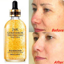 2X1 SOLO HOY SERUM 24K GOLD 100ML ¡COMIENZA BELLA EL 2026!